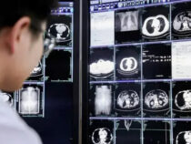 DAMO Academy Partners Up With WHO Collaborating Center On Digital Health To Advance Medical AI